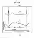 Fig. 15 - Image processing apparatus, image processing method, and storage medium