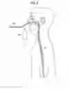 Fig. 07 - Methods and apparatus for guiding medical care based on detected gastric function