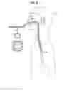 Fig. 10 - Methods and apparatus for guiding medical care based on detected gastric function