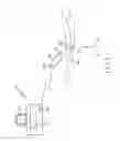 Fig. 02 - Use of micro- and miniature position sensing devices for use in tka and tha