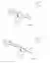 Fig. 04 - Use of micro- and miniature position sensing devices for use in tka and tha