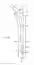 Fig. 17 - Use of micro- and miniature position sensing devices for use in tka and tha