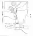 Fig. 06 - Systems and methods for diagnosis of middle ear conditions and detection of analytes in the tympanic membrane