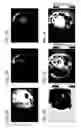 Fig. 08 - Systems and methods for diagnosis of middle ear conditions and detection of analytes in the tympanic membrane