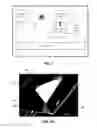 Fig. 02 - Implantable sensor