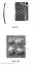 Fig. 04 - HIGH INTENSITY FOCUSED ULTRASOUND AND METHODS OF PERFORMING NON-INVASIVE BIOPSIES USING SAME