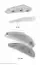 Fig. 05 - Automatic detection of teeth clenching and/or teeth grinding