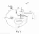 Fig. 02 - Direct integration of feedthrough to implantable medical device housing with ultrasonic welding