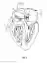 Fig. 07 - CONVERTIBLE BASKET CATHETER