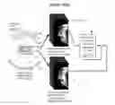 Fig. 01 - Converting low-dose to higher dose 3D tomosynthesis images through machine-learning processes
