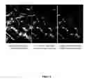 Fig. 08 - Converting low-dose to higher dose 3D tomosynthesis images through machine-learning processes