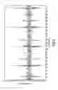 Fig. 06 - Heart rate detection method and device using heart sound acquired from auscultation positions