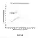 Fig. 12 - Heart rate detection method and device using heart sound acquired from auscultation positions