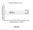 Fig. 33 - Heart rate detection method and device using heart sound acquired from auscultation positions