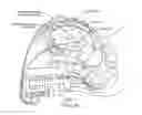 Fig. 02 - Electronic catheter stethoscope