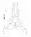 Fig. 13 - Forceps with locking mechanism