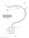 Fig. 02 - WEIGHTED SURGICAL RETRACTOR SYSTEMS
