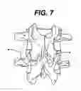 Fig. 06 - Configured and sized cannula