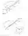 Fig. 18 - DEVICES AND METHODS FOR CLOSING OPENINGS IN BODY TISSUE
