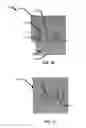 Fig. 24 - Devices, systems, and methods for attaching soft tissue to bone tissue