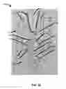 Fig. 25 - Devices, systems, and methods for attaching soft tissue to bone tissue