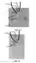 Fig. 26 - Devices, systems, and methods for attaching soft tissue to bone tissue
