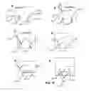 Fig. 32 - Devices, systems, and methods for attaching soft tissue to bone tissue