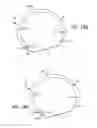 Fig. 23 - Apparatus and method for minimally invasive suturing