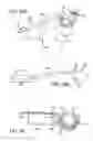 Fig. 41 - Apparatus and method for minimally invasive suturing