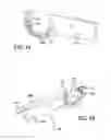 Fig. 44 - Apparatus and method for minimally invasive suturing