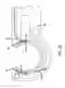 Fig. 53 - Apparatus and method for minimally invasive suturing