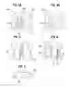 Fig. 03 - Systems for deploying knotless suture anchoring clamps