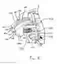 Fig. 09 - Surgical fastening instrument