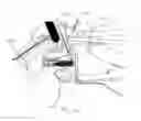 Fig. 13 - Surgical fastening instrument