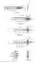 Fig. 04 - Device and method for establishing an artificial arterio-venous fistula