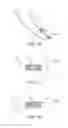 Fig. 08 - Device and method for establishing an artificial arterio-venous fistula
