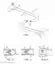 Fig. 02 - Methods and devices for passive residual lung volume reduction and functional lung volume expansion
