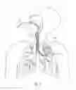 Fig. 03 - Methods and devices for passive residual lung volume reduction and functional lung volume expansion