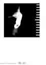 Fig. 30 - Polymeric electrospun embolization device and methods of use