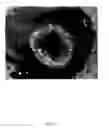 Fig. 35 - Polymeric electrospun embolization device and methods of use