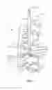 Fig. 08 - Surgical instrument and method