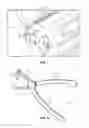 Fig. 04 - Surgical metal debris reduction system
