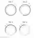 Fig. 07 - METHOD AND DEVICE FOR IMPROVING PASSAGE OF ELECTROHYDRAULIC LITHOTRIPSY PROBE