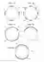 Fig. 09 - METHOD AND DEVICE FOR IMPROVING PASSAGE OF ELECTROHYDRAULIC LITHOTRIPSY PROBE