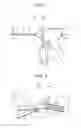 Fig. 02 - Medical treatment implement