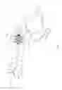 Fig. 03 - Steerable Laparoscopic Instrument
