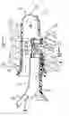 Fig. 01 - Endoluminal treatment method and associated surgical assembly
