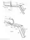 Fig. 08 - Endoluminal treatment method and associated surgical assembly
