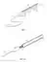 Fig. 02 - Atherectomy device