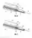 Fig. 06 - Atherectomy device